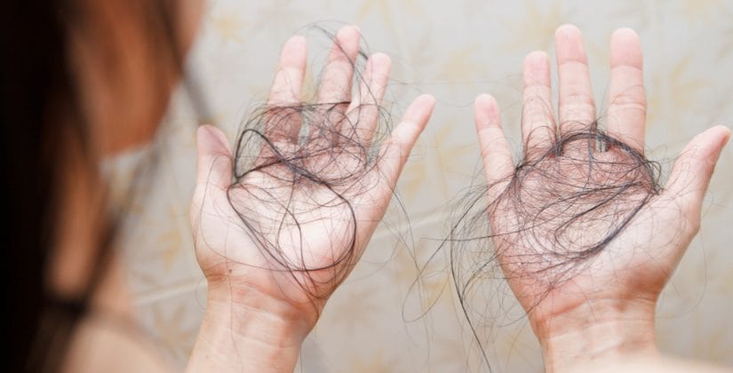 Queda de Cabelo