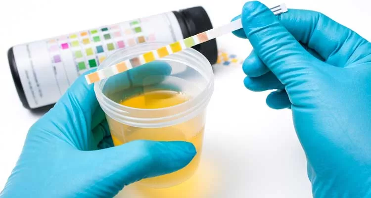 Análise de Urina: Um Exame Essencial para Identificar Infecções, Diabetes e Doenças Renais