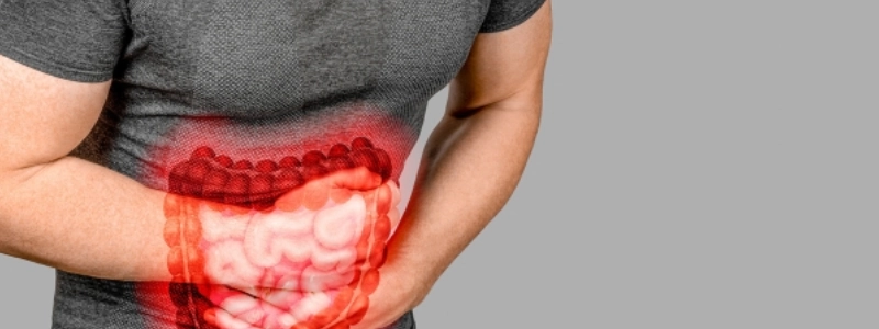 Doença de Crohn: Causas, Sintomas, Diagnóstico e Tratamento