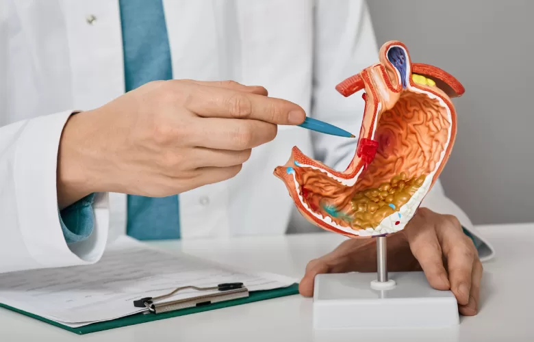 Gastrite: O Que É, Para Que Serve o Tratamento, Sintomas, Efeitos Colaterais, Como Usar Medicamentos, Receita Necessária e Alternativas Naturais