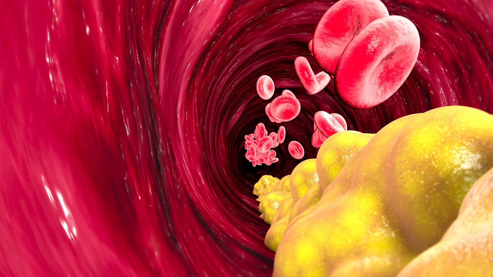 Lipidograma: O Que é, Para Que Serve e Como Interpretar