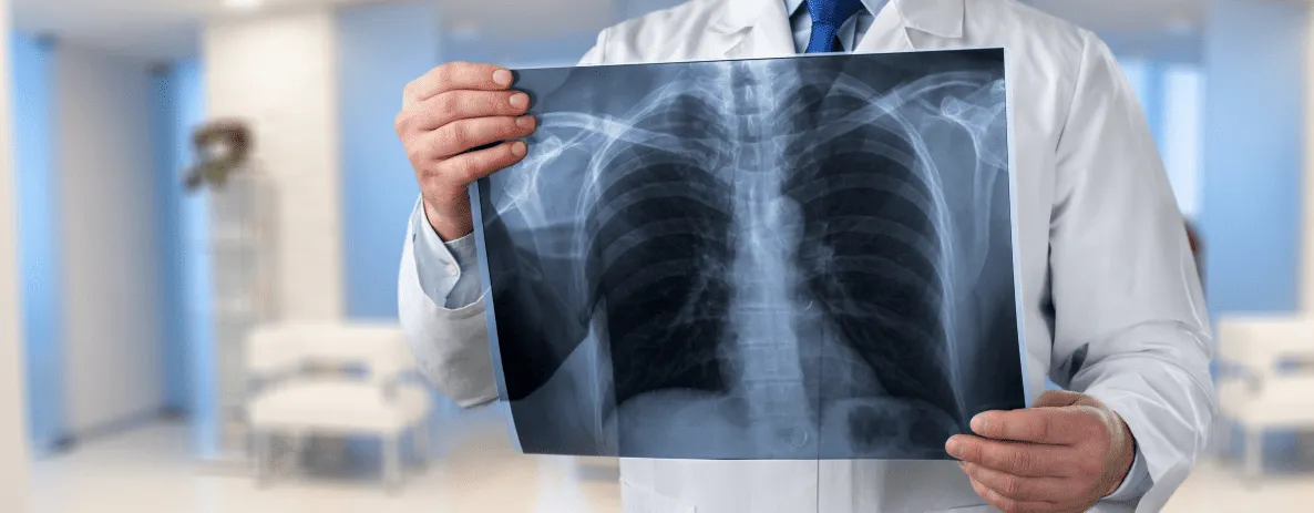 Raio-X: Desvendando o Corpo com Imagens por Radiação