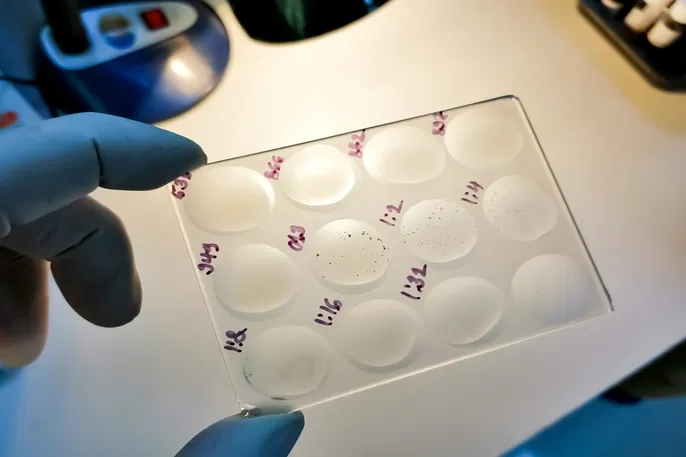 Sorologia para Lues (VDRL): Entendendo o Exame para Sífilis